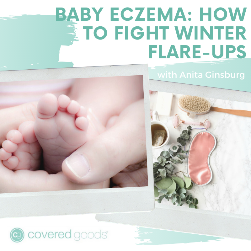 Baby Eczema: How to Fight Winter Flare-Ups